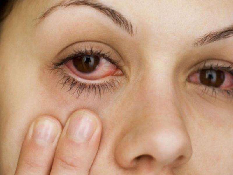 Mắt phải của nữ giật có thể do các bệnh lý về mắt